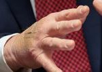 Biely dom vysvetluje naplasti na ruke Trumpa