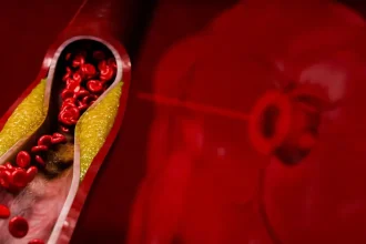Tiché príznaky vysokého cholesterolu: Ako ich spoznať včas?