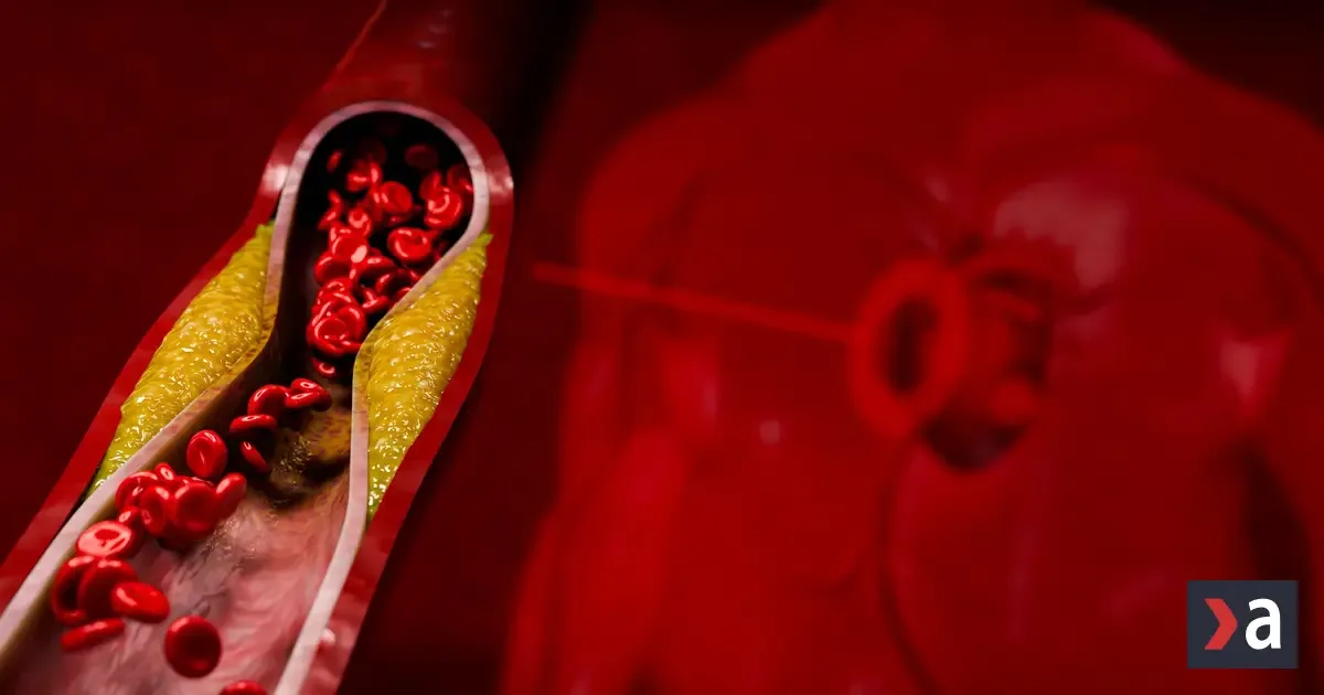 Tiché príznaky vysokého cholesterolu: Ako ich spoznať včas?