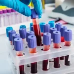 Nový slovenský test môže zrýchliť diagnostiku rakoviny