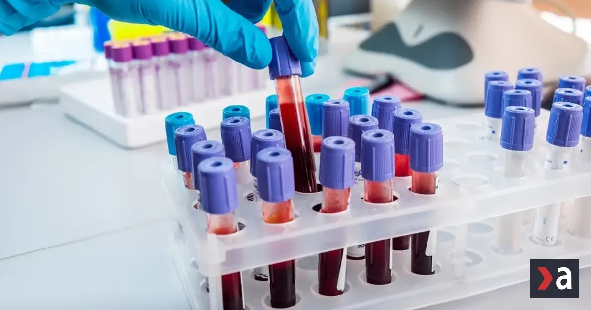 Nový slovenský test môže zrýchliť diagnostiku rakoviny